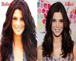 Ashley Greene before surgery